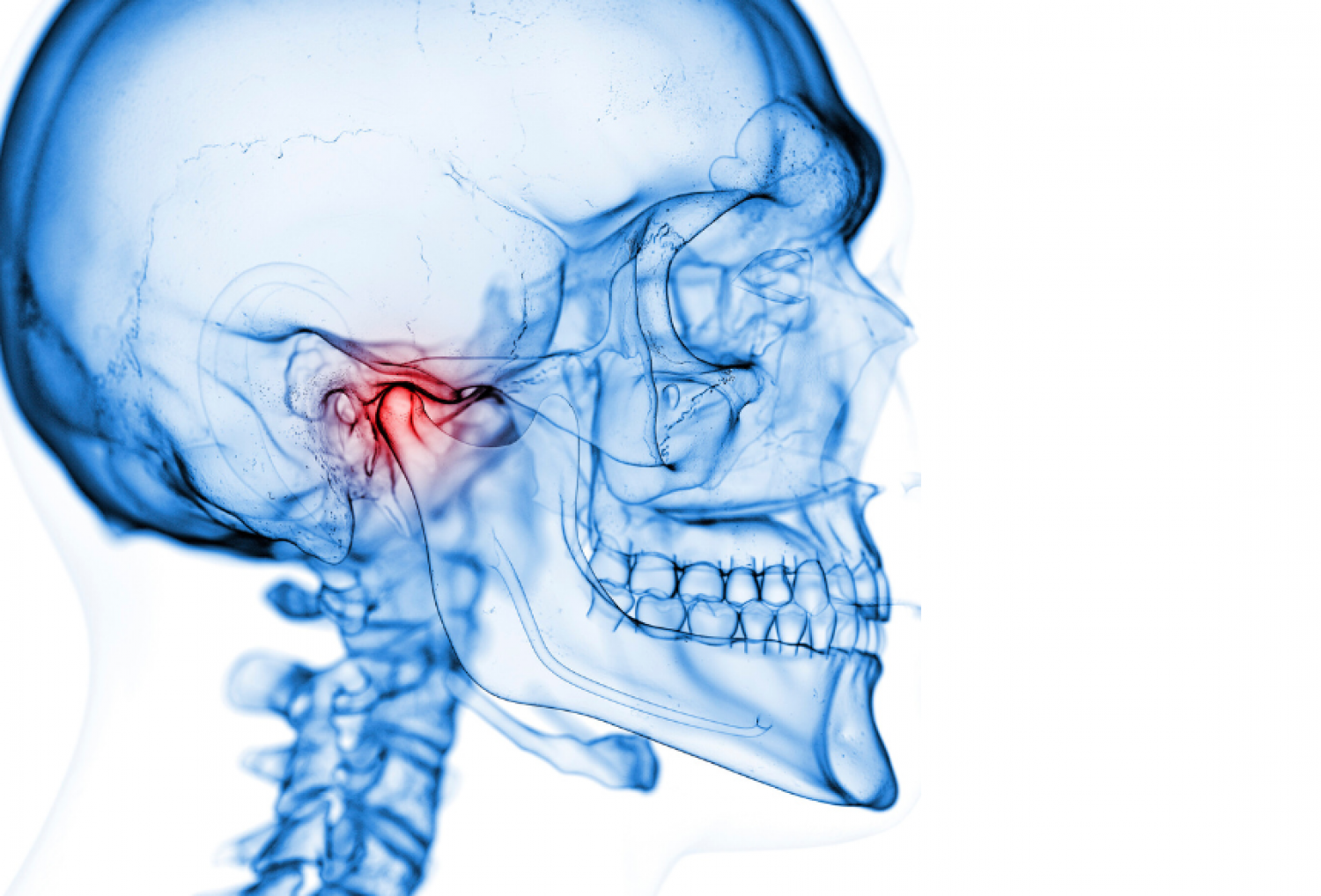 skull - TMJ